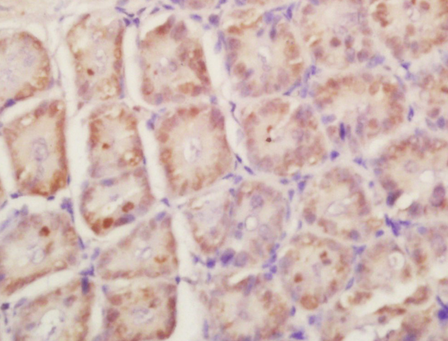 14 - RPLP0 Rabbit pAb AP57282