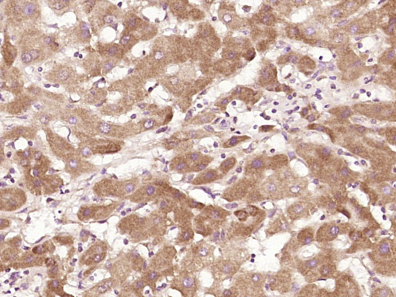 14 - RSPH6A Rabbit pAb AP57284