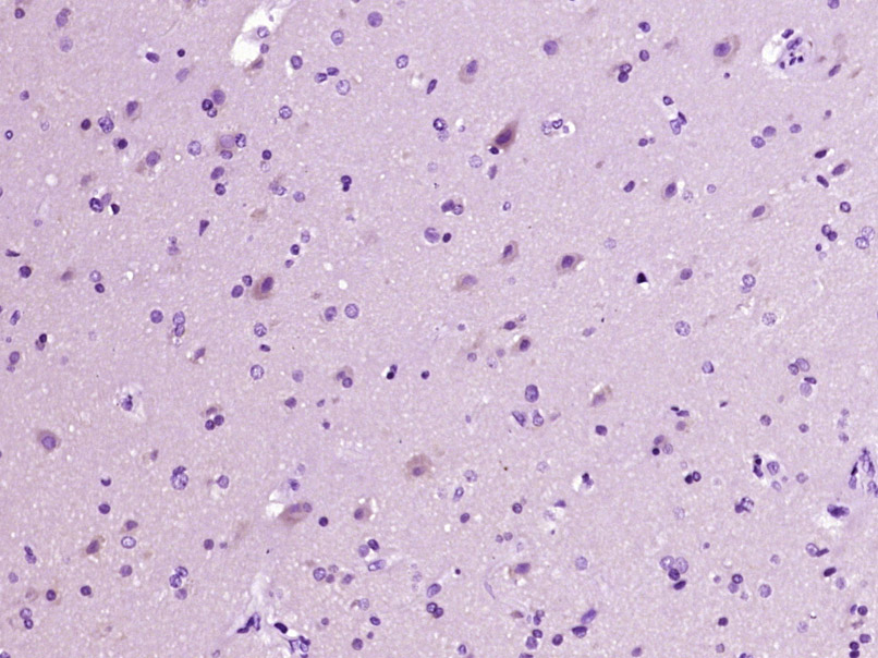 14 - AMD1/SAMDC Rabbit pAb AP57286