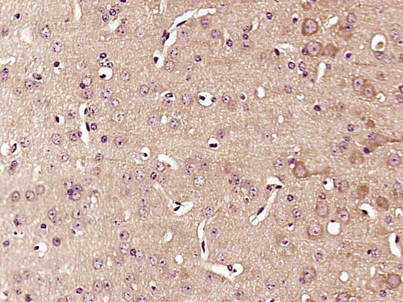 14 - MGAT5B Rabbit pAb AP57305