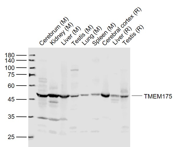 1 - TMEM175 Rabbit pAb AP57311