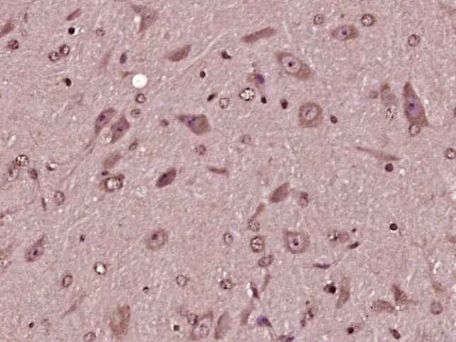 14 - MZT1 Rabbit pAb AP57333