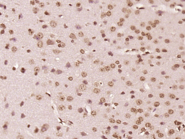 14 - Nance-Horan Syndrome Protein Rabbit pAb AP57351