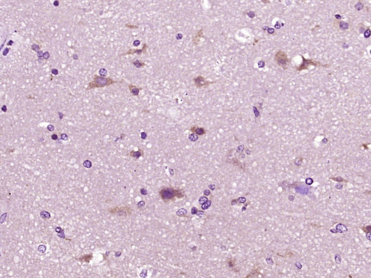 14 - NBPF10 Rabbit pAb AP57362