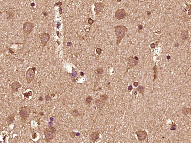 14 - NBPF8 Rabbit pAb AP57367
