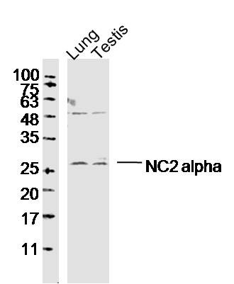 1 - NC2 alpha Rabbit pAb AP57368