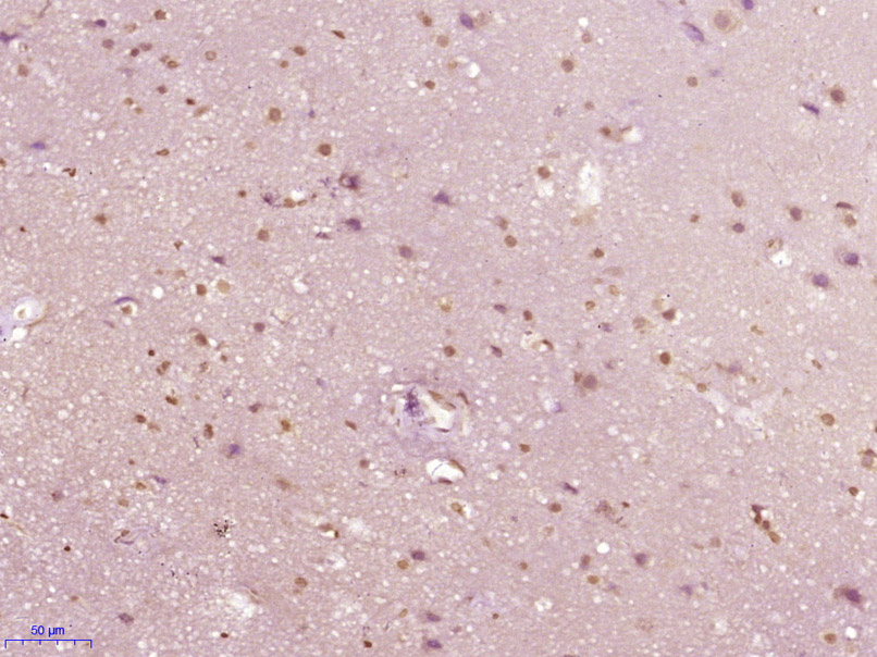 14 - NCKIPSD Rabbit pAb AP57371