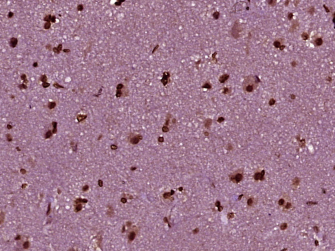 14 - NCOA5 Rabbit pAb AP57372