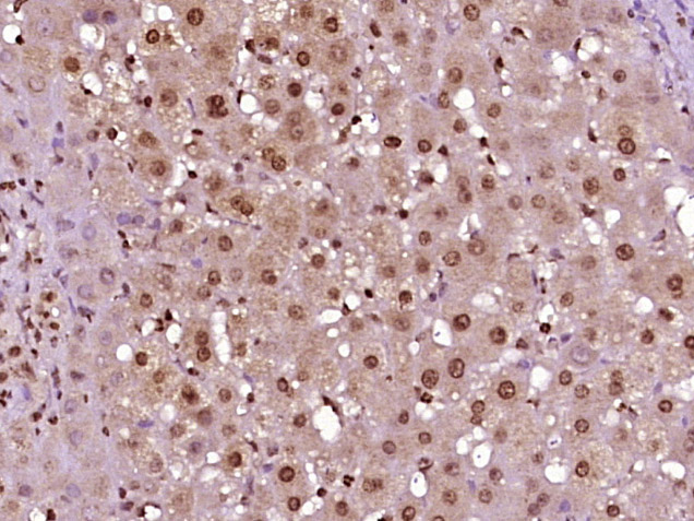 14 - NCRNA00114 Rabbit pAb AP57374
