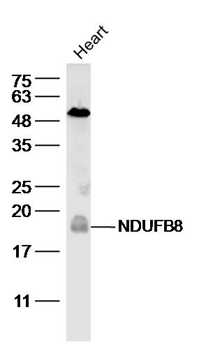 1 - NDUFB8 Rabbit pAb AP57389