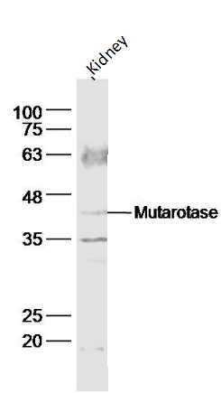 1 - Mutarotase Rabbit pAb AP57398