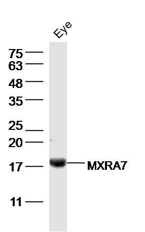 1 - MXRA7 Rabbit pAb AP57400