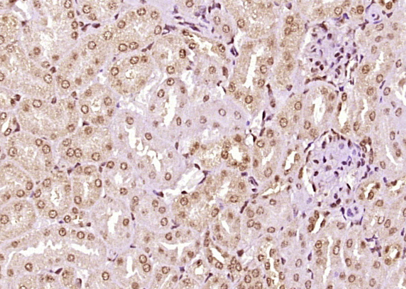 14 - ZFP472 Rabbit pAb AP57403