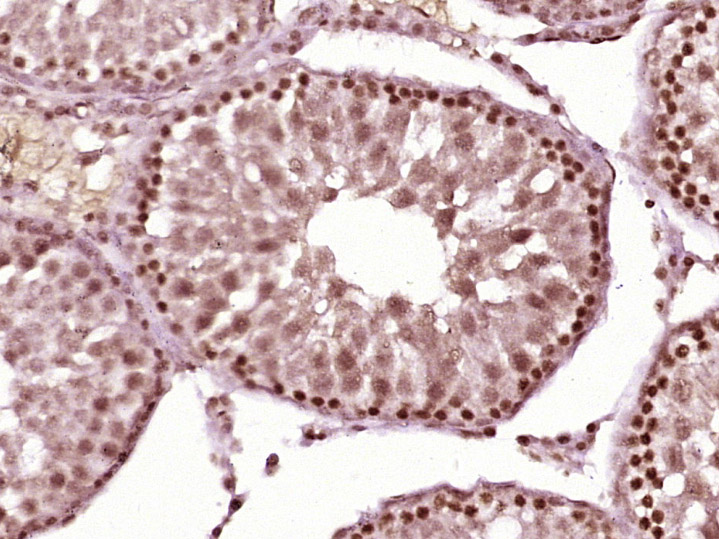 14 - ZFP62 Rabbit pAb AP57404