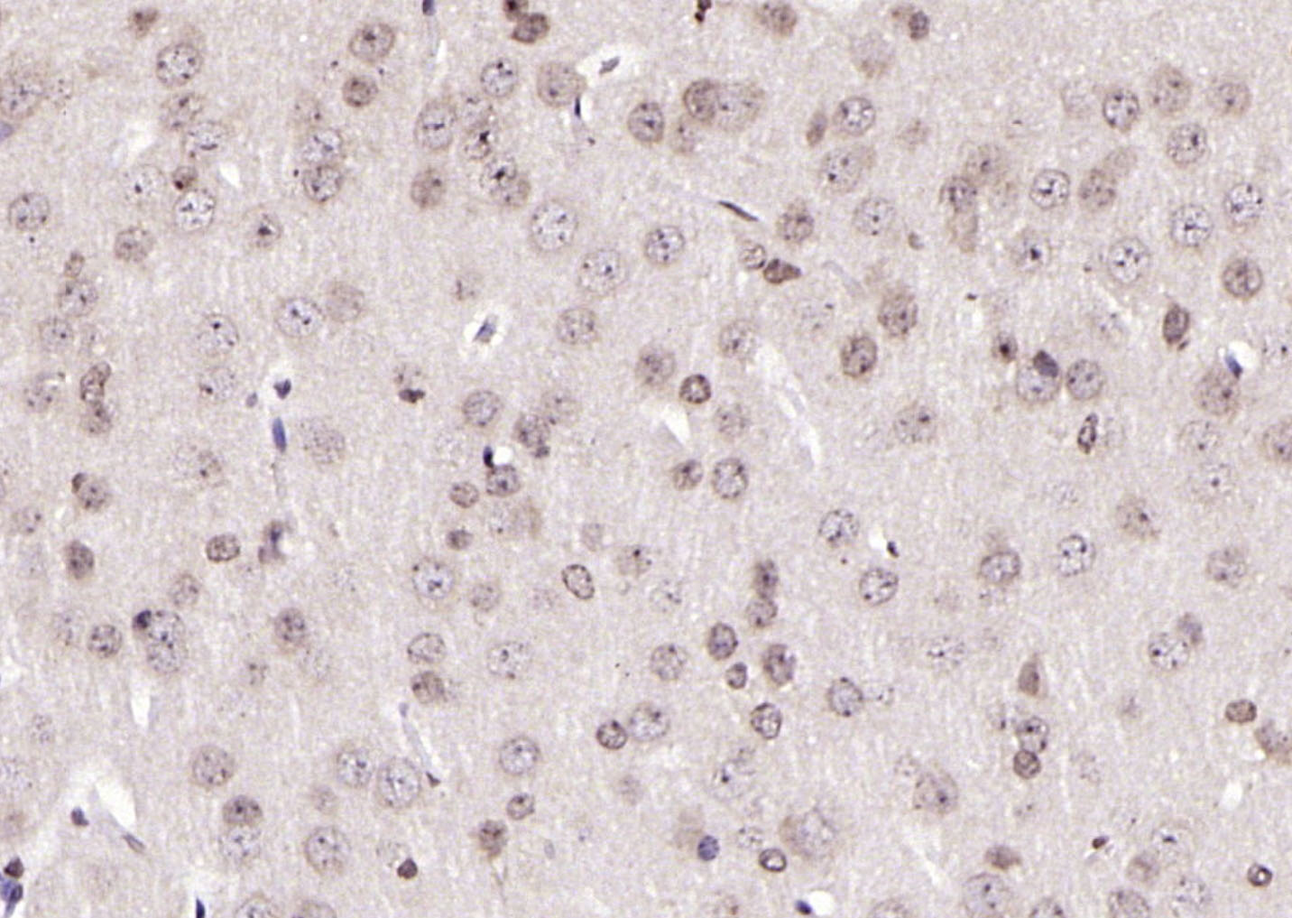 14 - ZFP72 Rabbit pAb AP57405