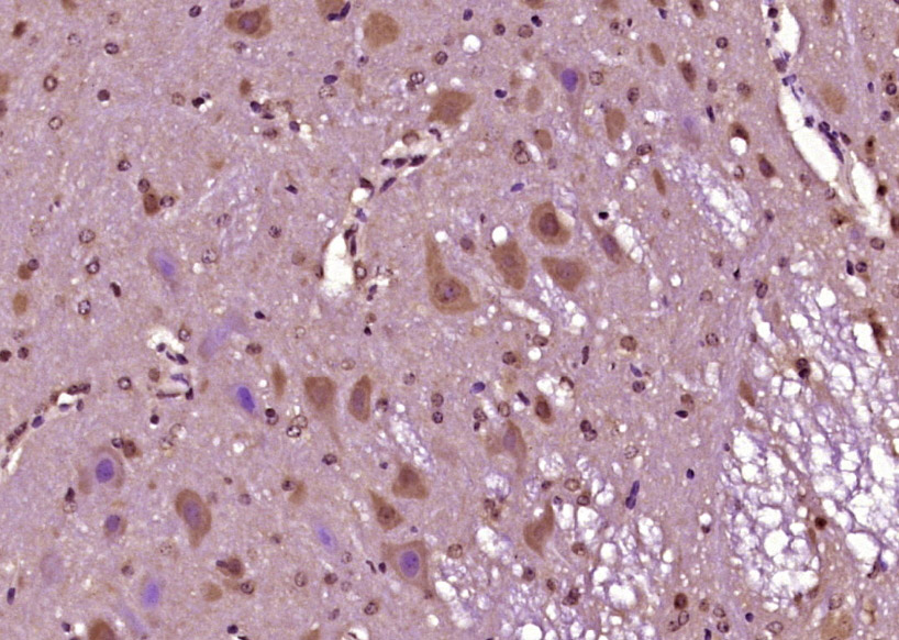 14 - ZFP759 Rabbit pAb AP57406