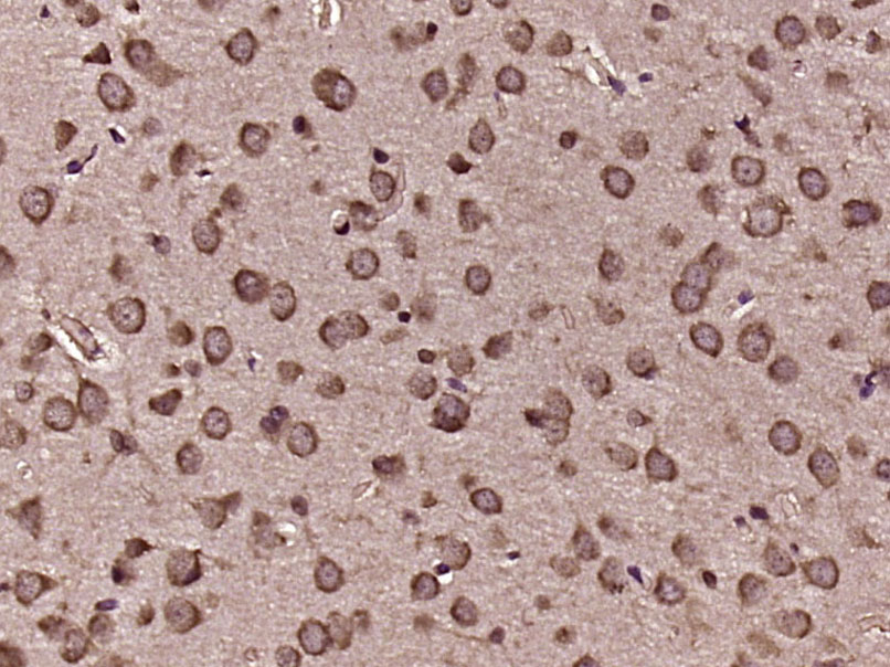 14 - MYO15A Rabbit pAb AP57413