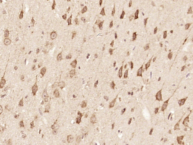 14 - ZFYVE26 Rabbit pAb AP57417