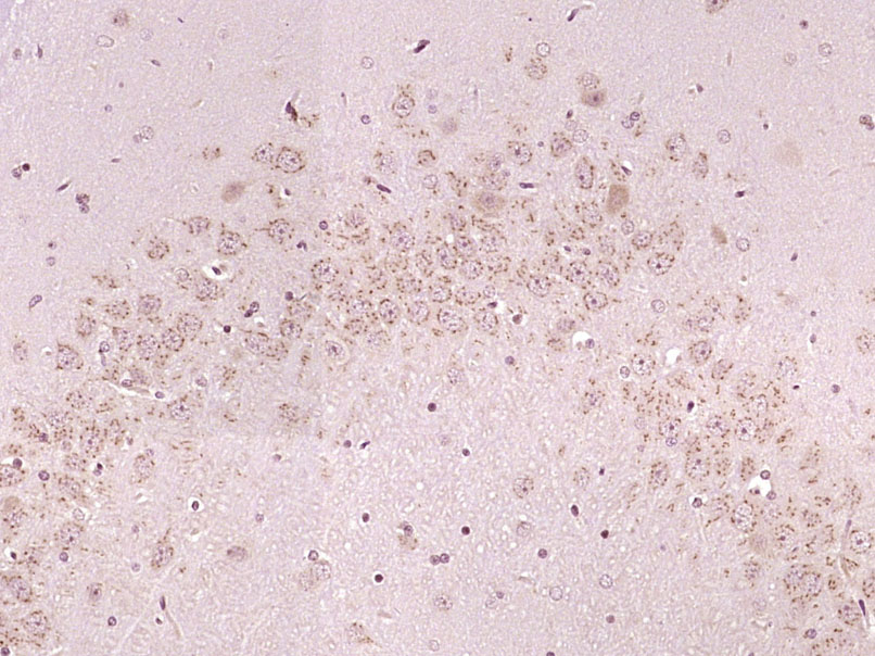 14 - MYO16 Rabbit pAb AP57419