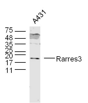 1 - Rarres3 Rabbit pAb AP57431