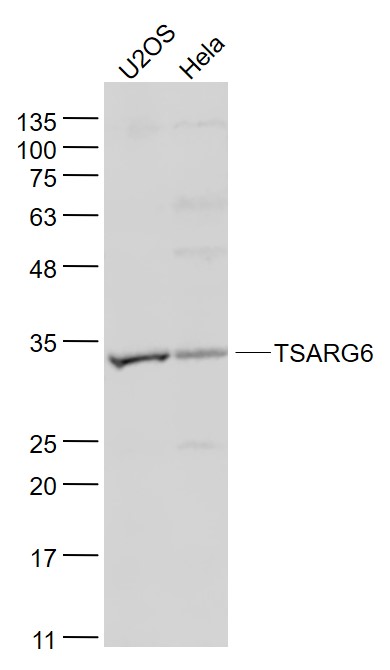 1 - TSARG6 Rabbit pAb AP57451
