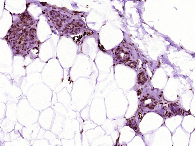 14 - BarX2 Rabbit pAb AP57458