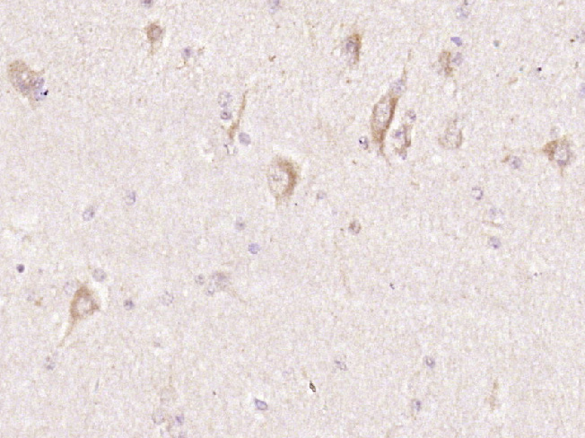 14 - NLRC5 Rabbit pAb AP57462