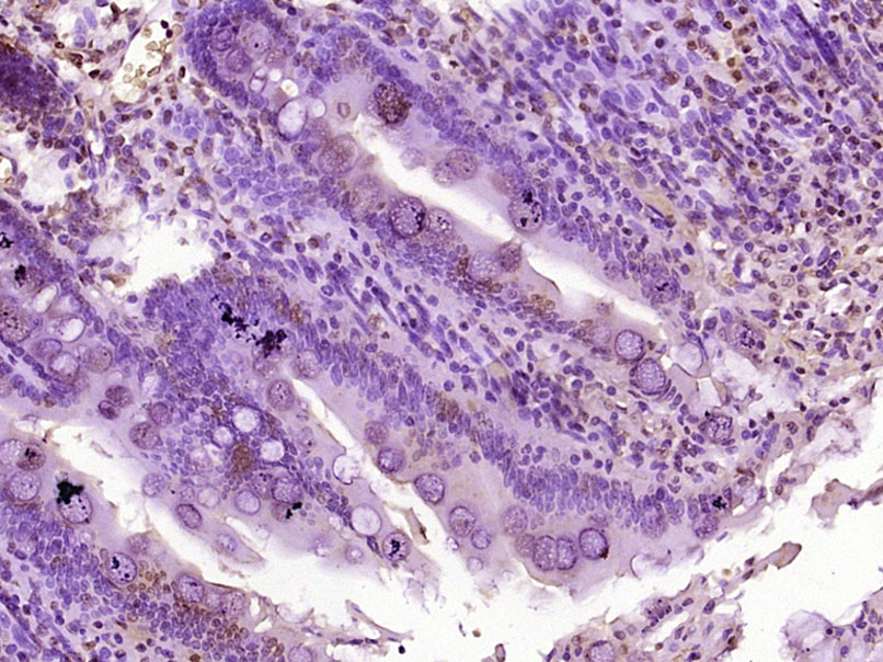 14 - NMES1 Rabbit pAb AP57465