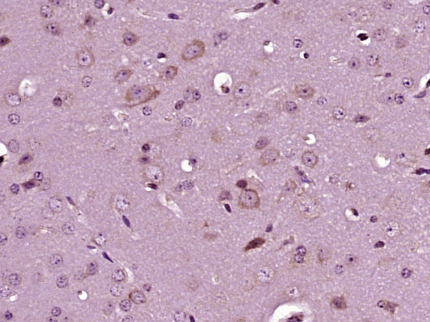 14 - NRDE2 Rabbit pAb AP57483
