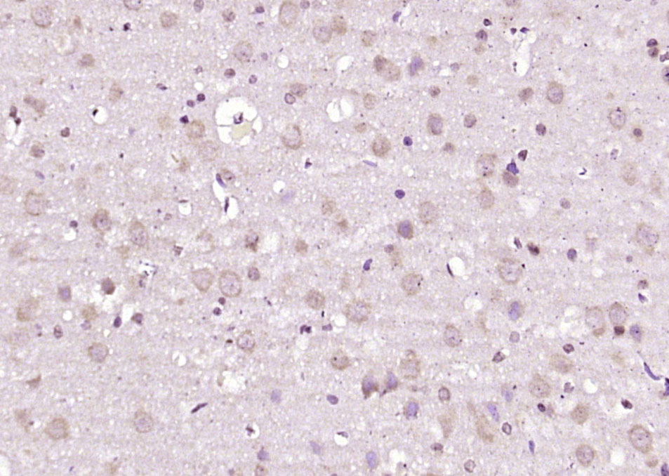 14 - SAH3 Rabbit pAb AP57491