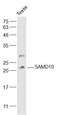 1 - SAMD10 Rabbit pAb AP57493