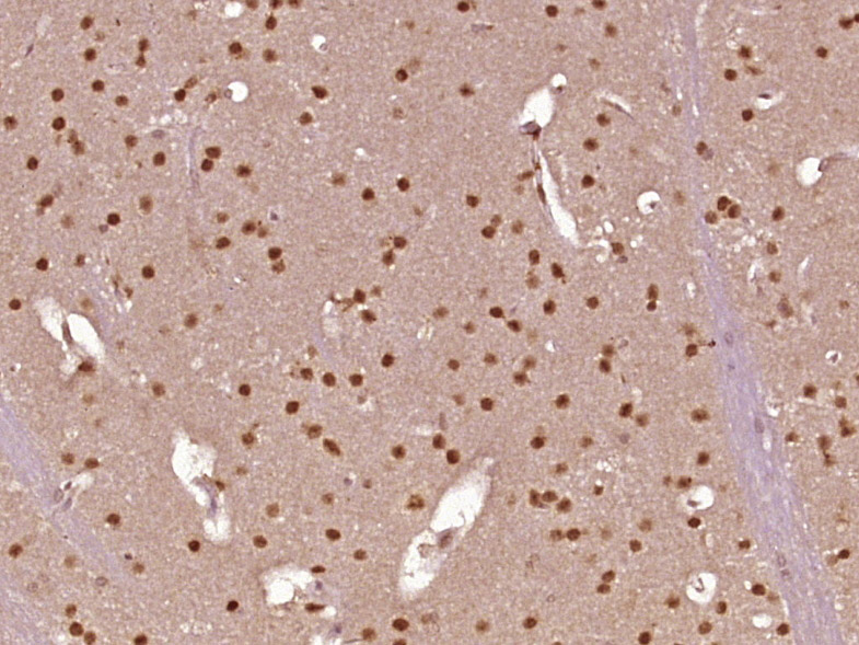 14 - PRPF40B Rabbit pAb AP57508