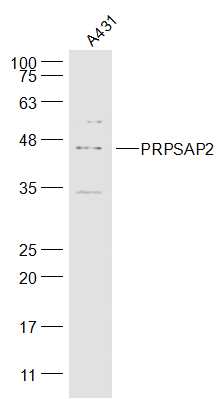 1 - PRPSAP2 Rabbit pAb AP57509