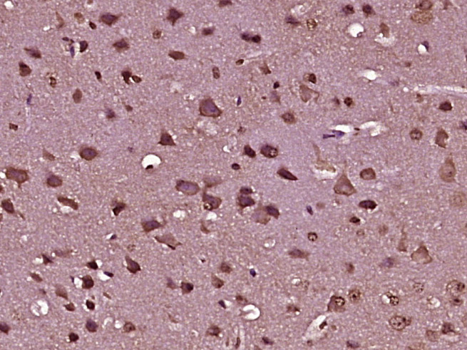14 - Prune homolog 2/C9orf65 Rabbit pAb AP57524
