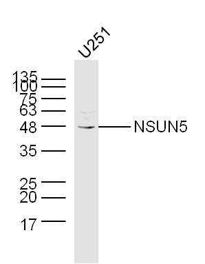 1 - NSUN5 Rabbit pAb AP57538