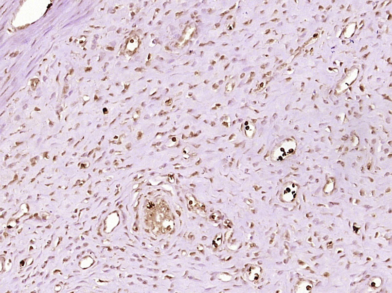 14 - NSUN5P1 Rabbit pAb AP57539