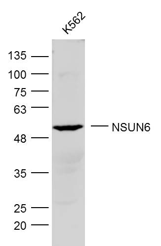 1 - NSUN6 Rabbit pAb AP57542