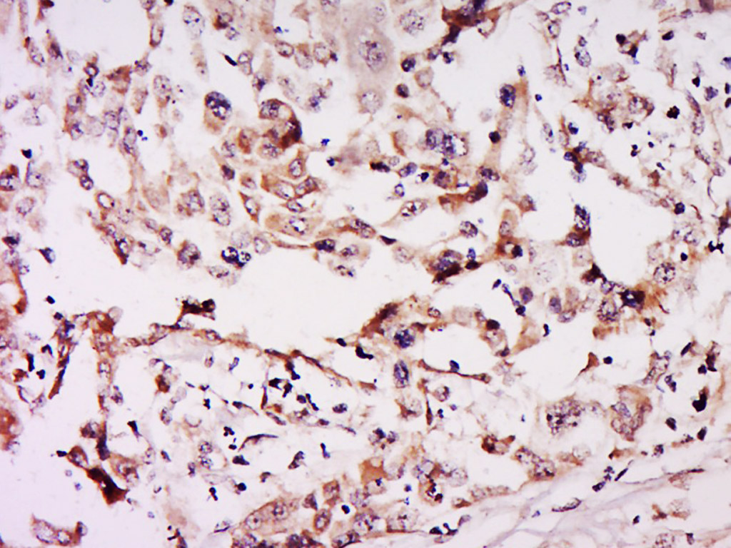 14 - NSUN6 Rabbit pAb AP57542