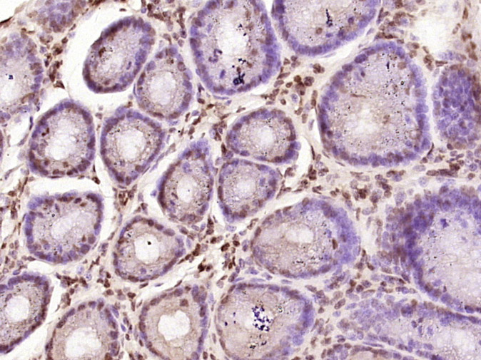 14 - ZNF569 Rabbit pAb AP57559