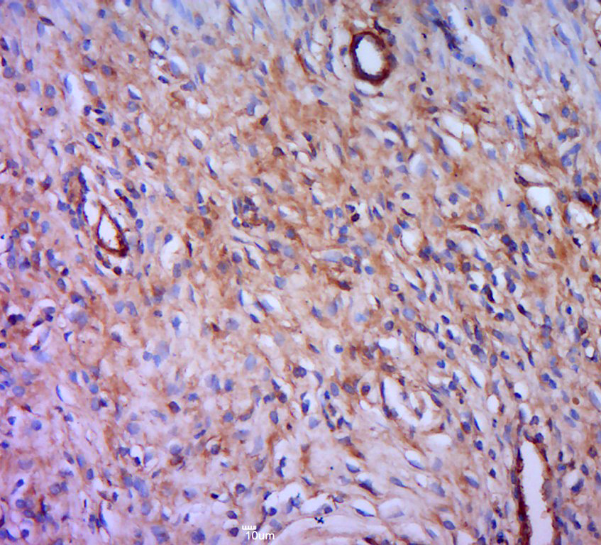 14 - PSTPIP2 Rabbit pAb AP57584