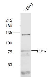 1 - PUS7 Rabbit pAb AP57591
