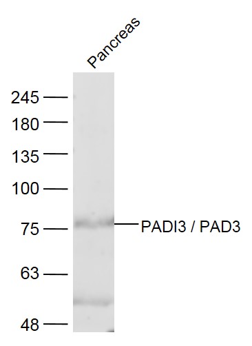 1 - PADI3 / PAD3 Rabbit pAb AP57601