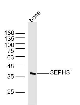 1 - SEPHS1 Rabbit pAb AP57603