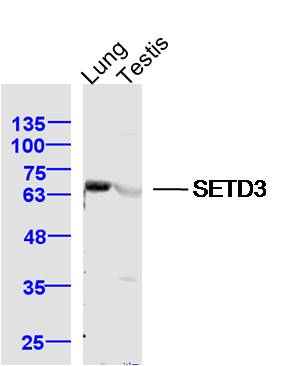 1 - SETD3 Rabbit pAb AP57614