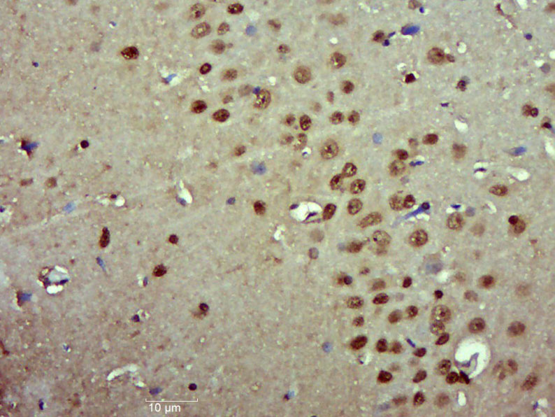 14 - Pygopus 2 Rabbit pAb AP57625