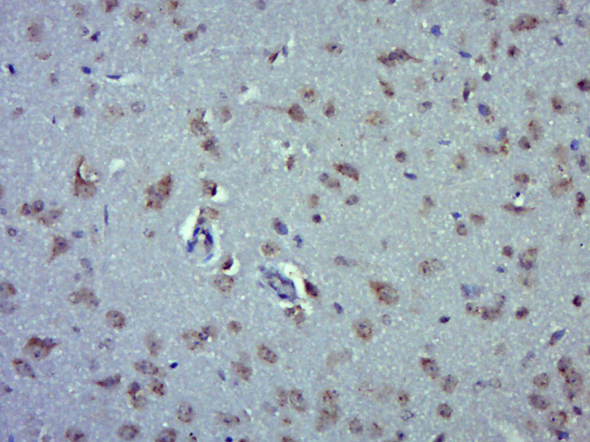 14 - QTRTD1 Rabbit pAb AP57628