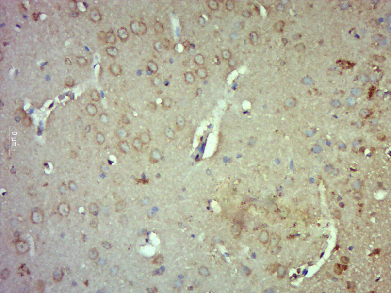 14 - R3HCC1 Rabbit pAb AP57630