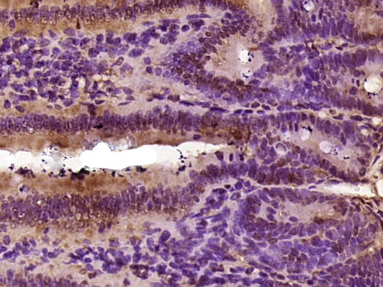 14 - R3HDM2 Rabbit pAb AP57631