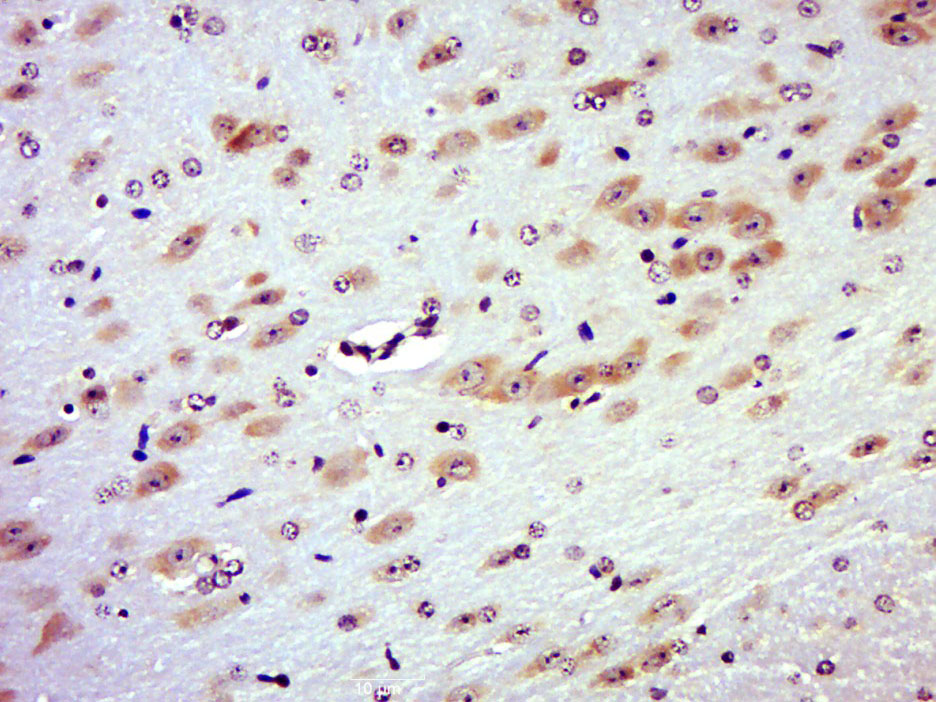 14 - RAB3IL1 Rabbit pAb AP57638