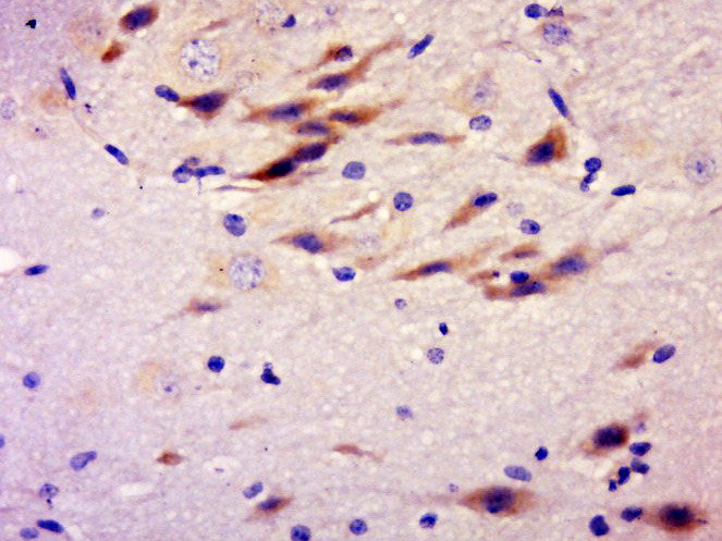 14 - RASGRP4 Rabbit pAb AP57643